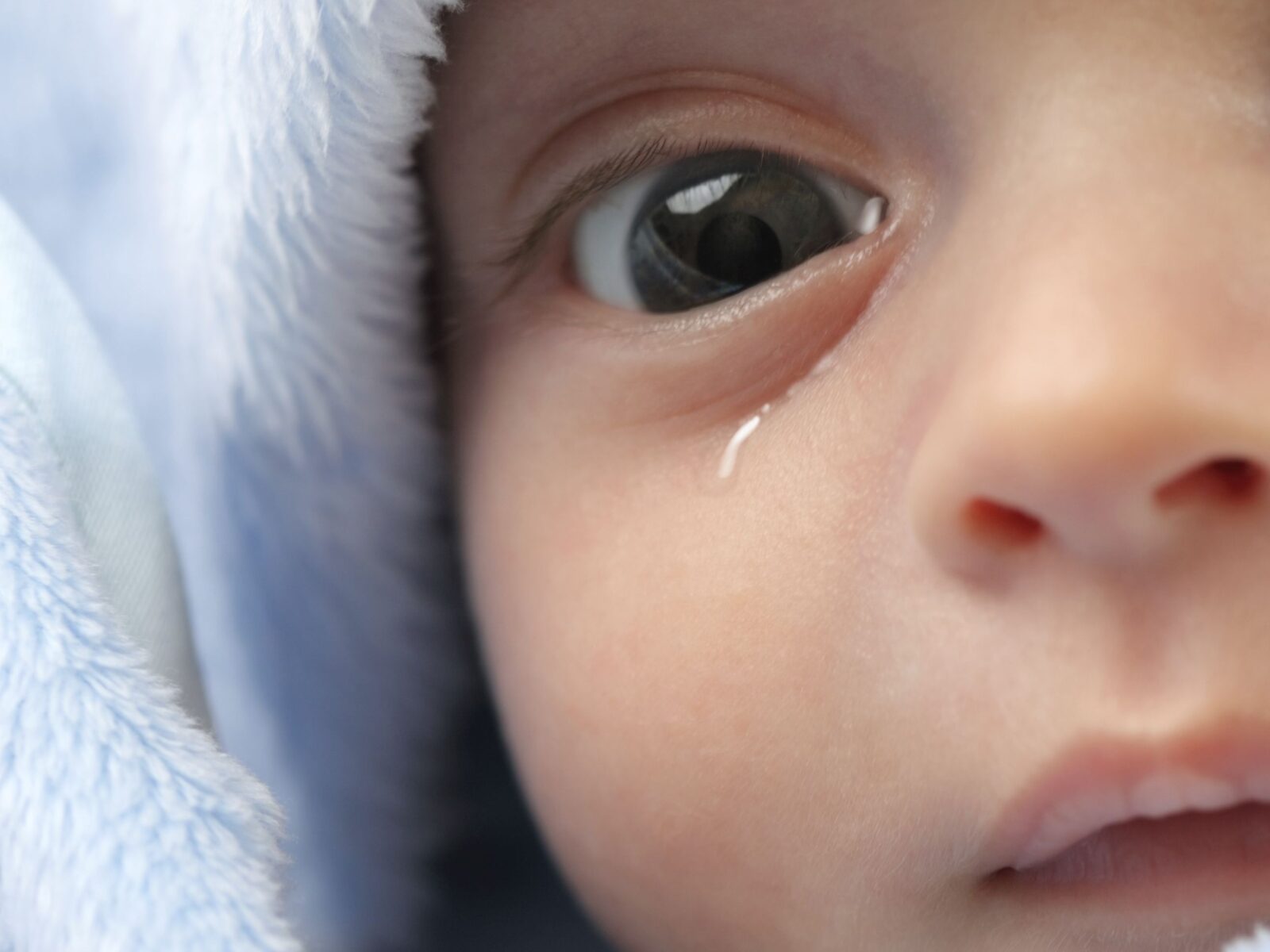 انسداد القناة الدمعية في الرضع (Lacrimal duct obstruction in infants ...