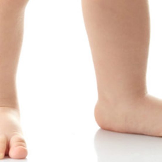 القدم المسطحة عند الأطفال