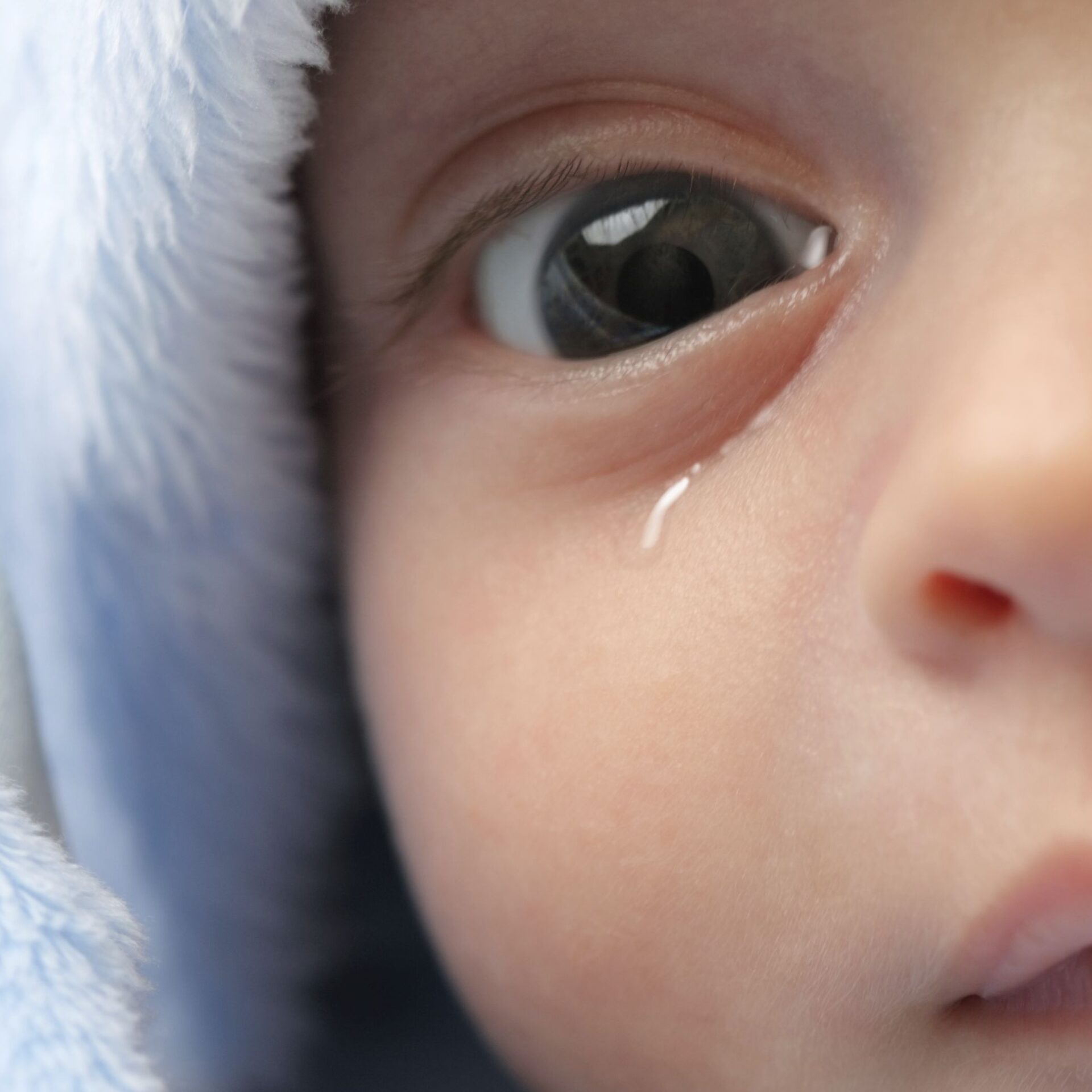 انسداد القناة الدمعية في الرضع

(Lacrimal duct obstruction in infants)


